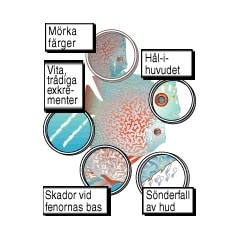 Esha Hexamita Mot Hålsjuka 20ml - 2